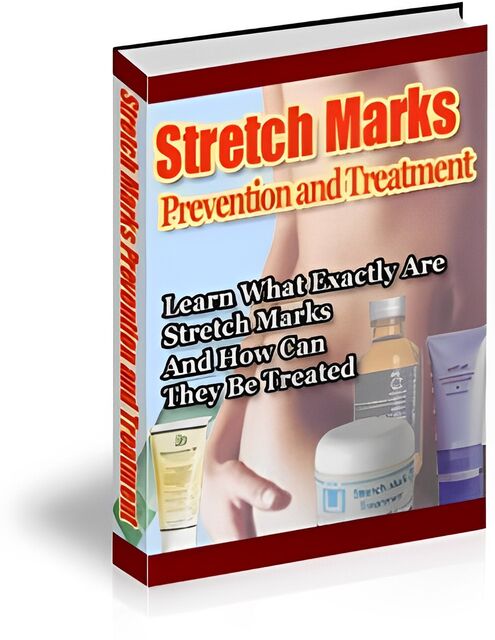 eCover representing Stretch Marks Prevention and Treatment eBooks & Reports with Private Label Rights